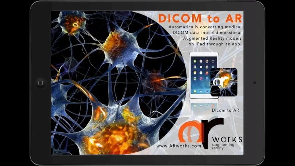 A 3D AR model made from DICOM data on an iPad, above a poster